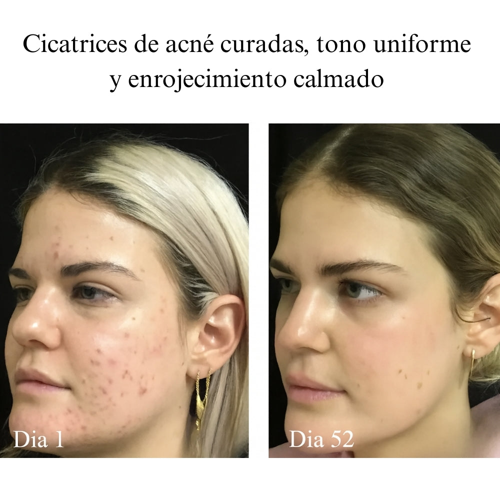 Máscara LED Rejuvenecedora – Piel Firme y Joven