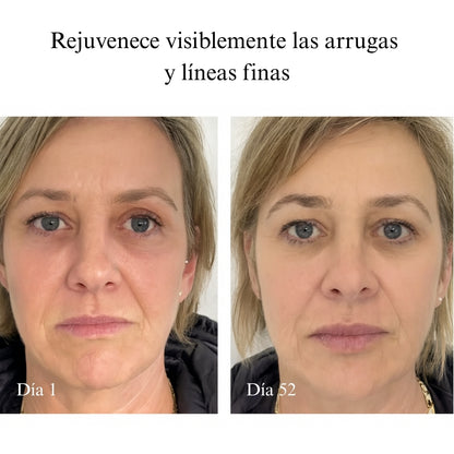 Máscara LED Rejuvenecedora – Piel Firme y Joven